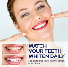 Load image into Gallery viewer, LED Teeth Whitening Kit