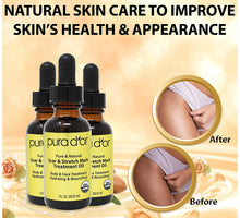 Load image into Gallery viewer, Stretch Mark Serum