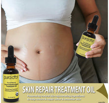 Load image into Gallery viewer, Stretch Mark Serum