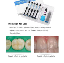 Load image into Gallery viewer, Professional Dental Bonding Kit (DIY Dental Kit)