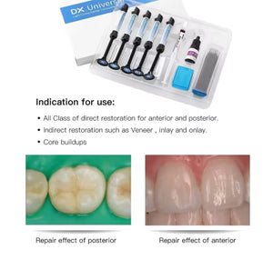 Professional Dental Bonding Kit (DIY Dental Kit)