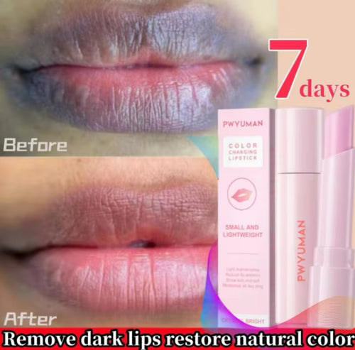 Hyperpigmentation Lip Corrector