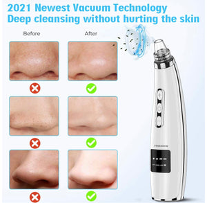 Pore Vacuum