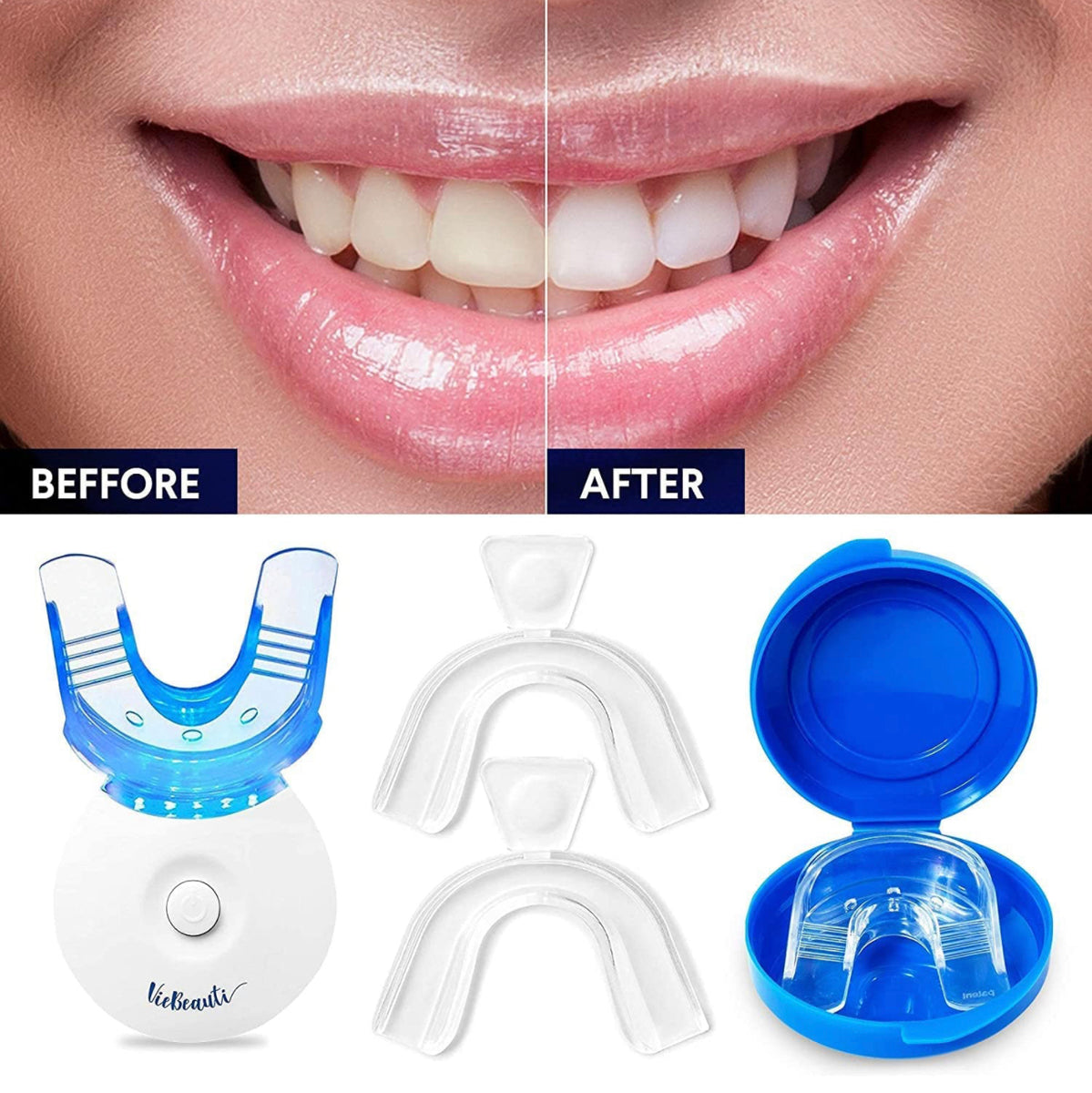 Teeth Whitening & Stain Remover – Beauty By Prima